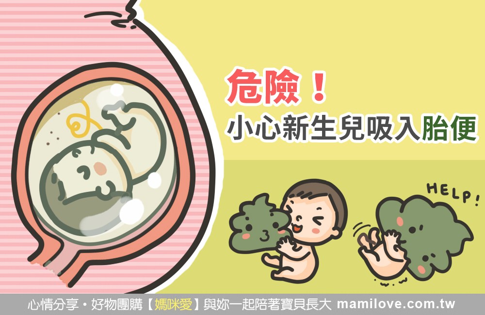生產危機！小心新生兒吸入胎便 - 育兒文章｜媽咪愛
