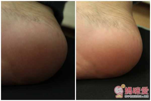 【現貨】Scholl爽健去硬皮機》別讓腳跟出賣妳！一分鐘和硬皮角質說掰掰~