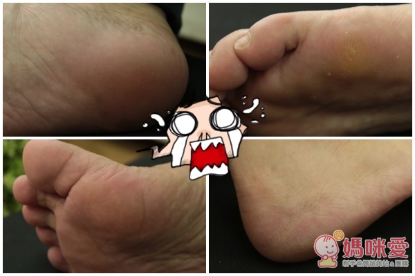 【現貨】Scholl爽健去硬皮機》別讓腳跟出賣妳！一分鐘和硬皮角質說掰掰~